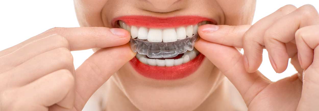 Invisalign Simcoe Dental Services
