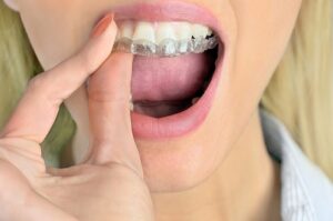 Why Wear a Mouth Guard?