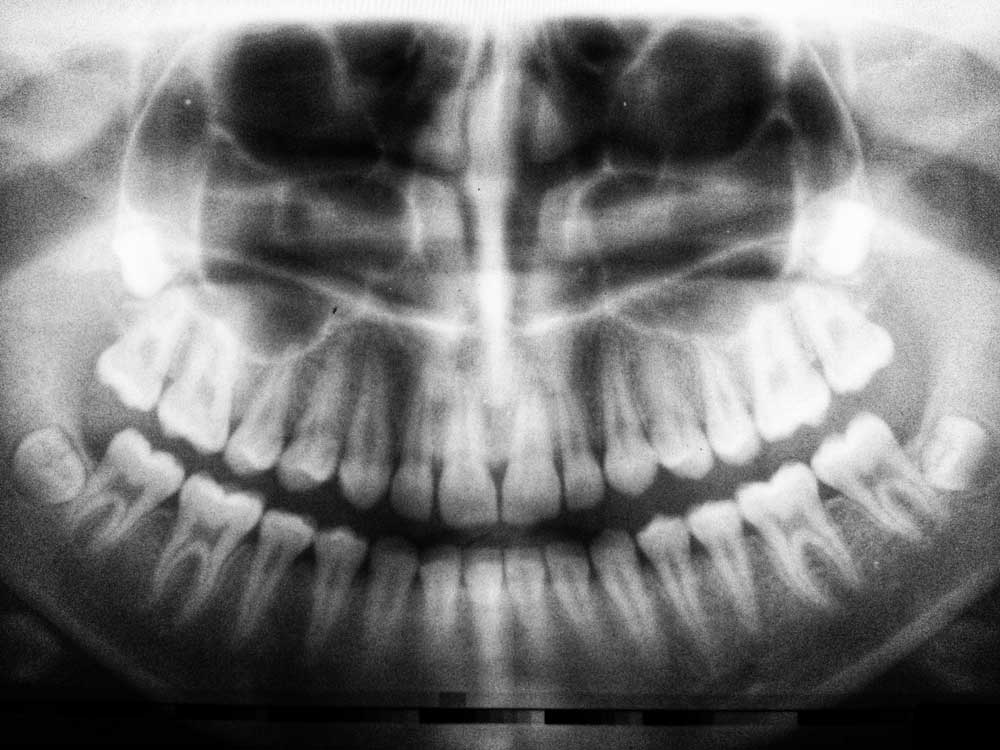 x-ray simcoe smile