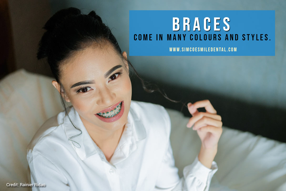 How Do I Know If I Need Braces